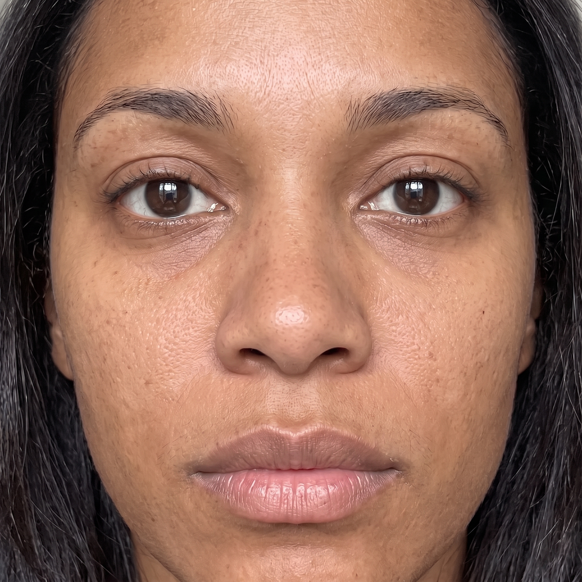 Skin before use