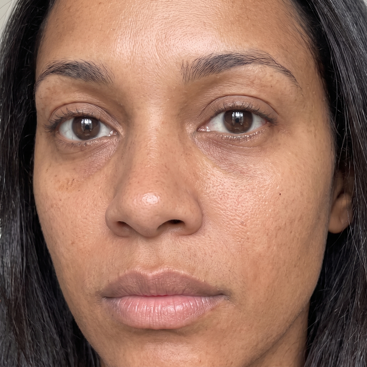 Skin after use