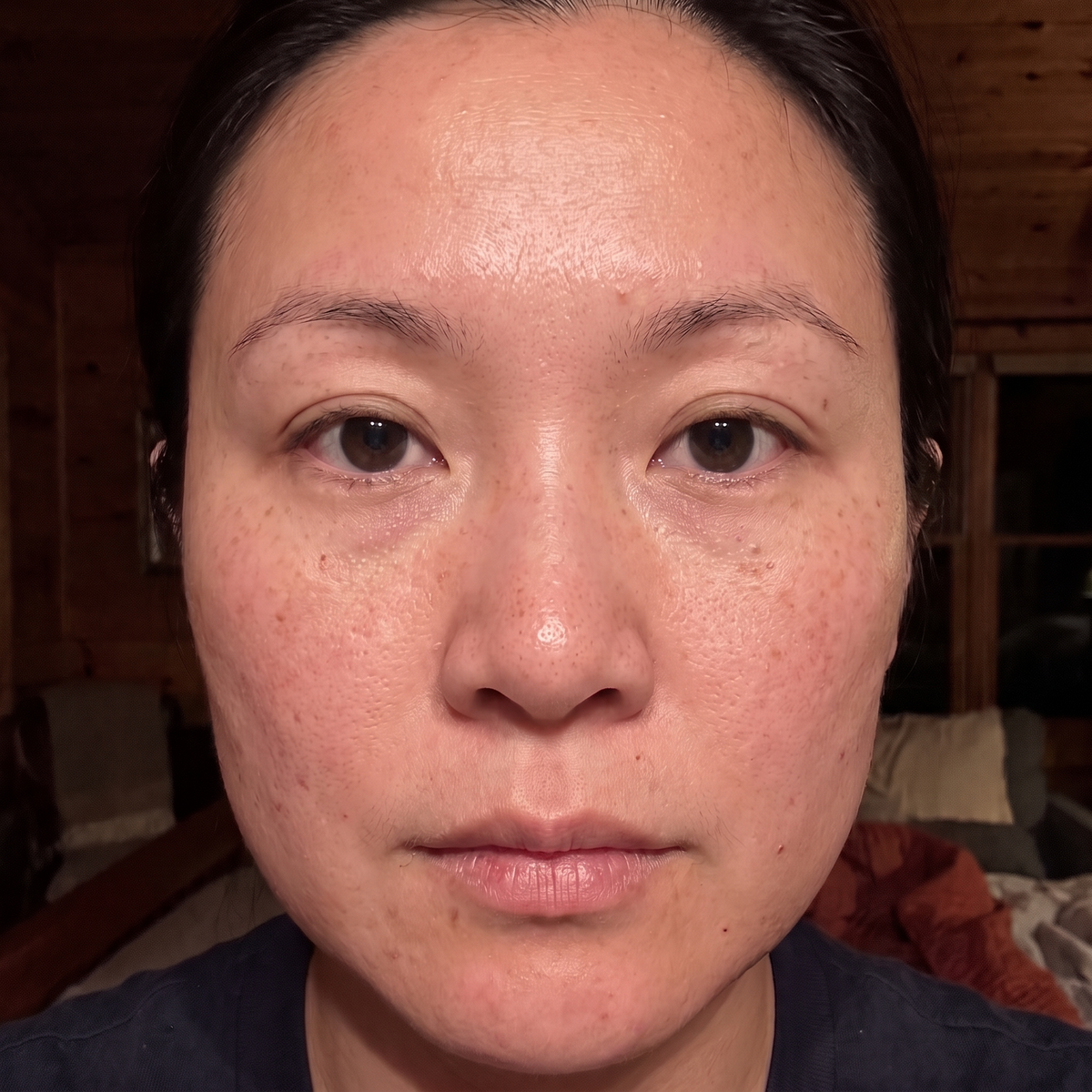 Skin before use